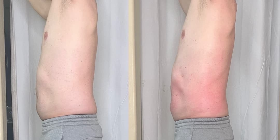client undefined before and after