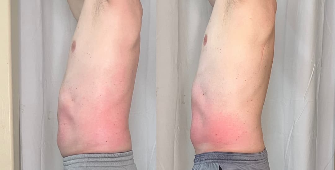 client undefined before and after