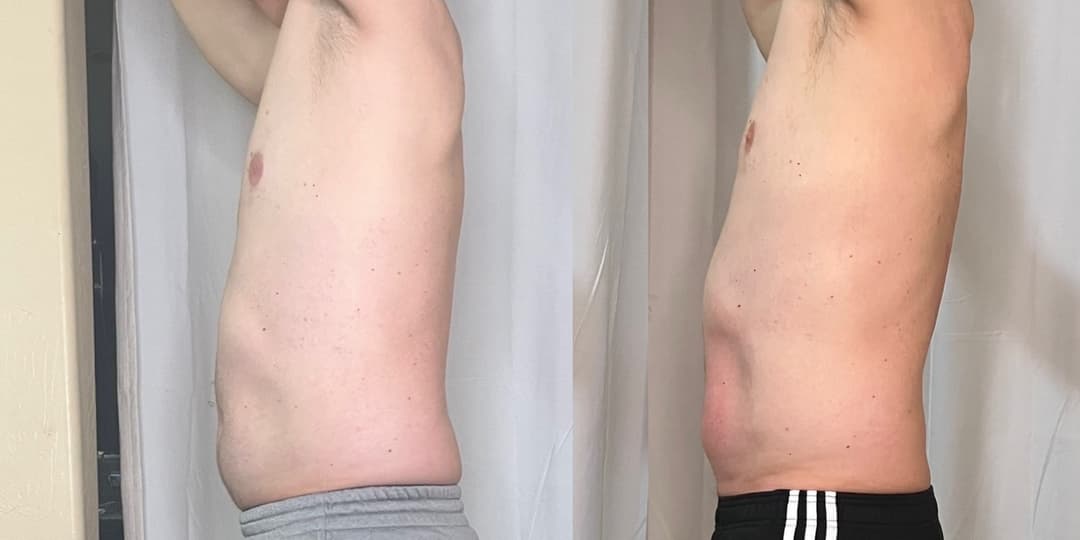 client undefined before and after