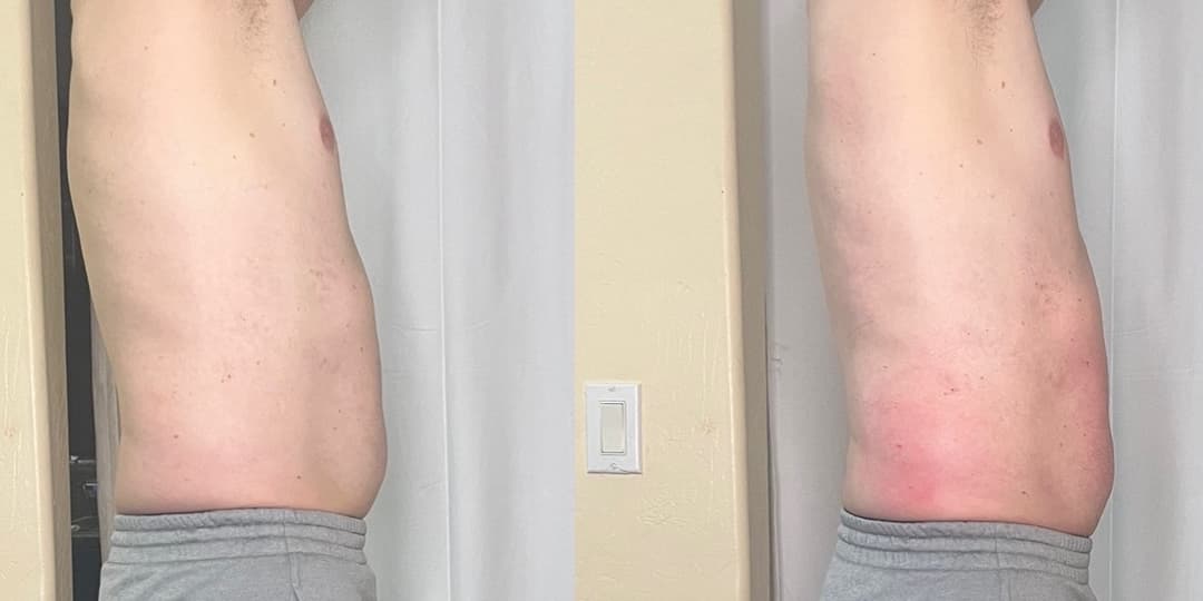 client undefined before and after