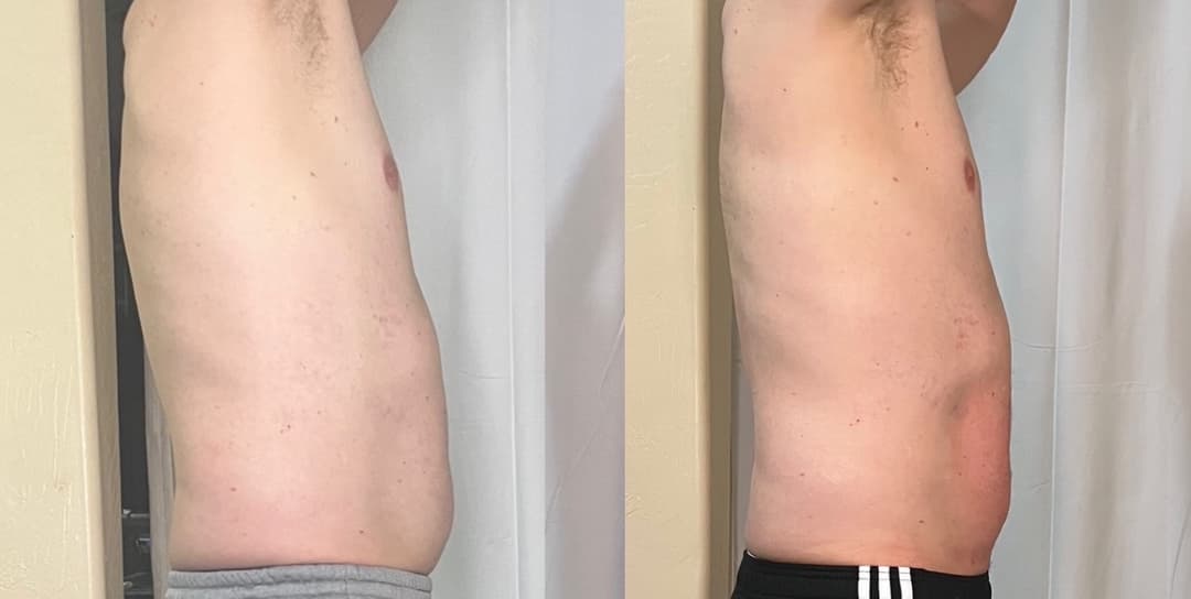 client undefined before and after