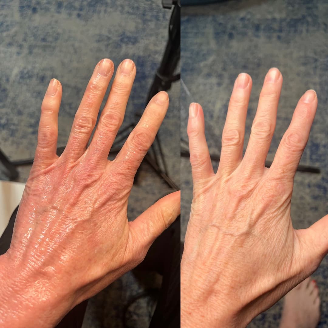 client undefined before and after