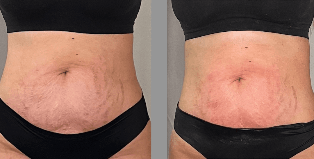 client undefined before and after