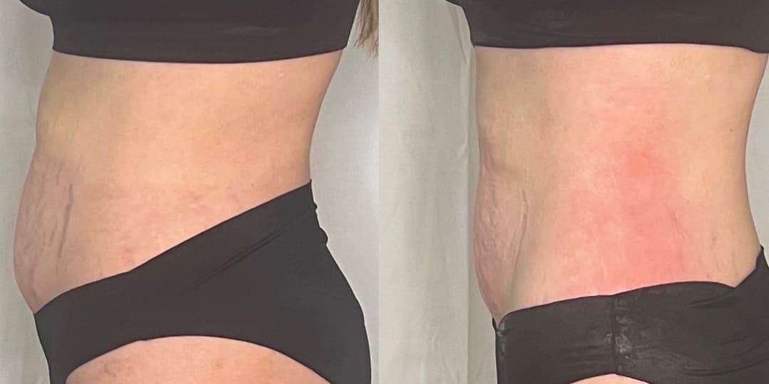 client undefined before and after