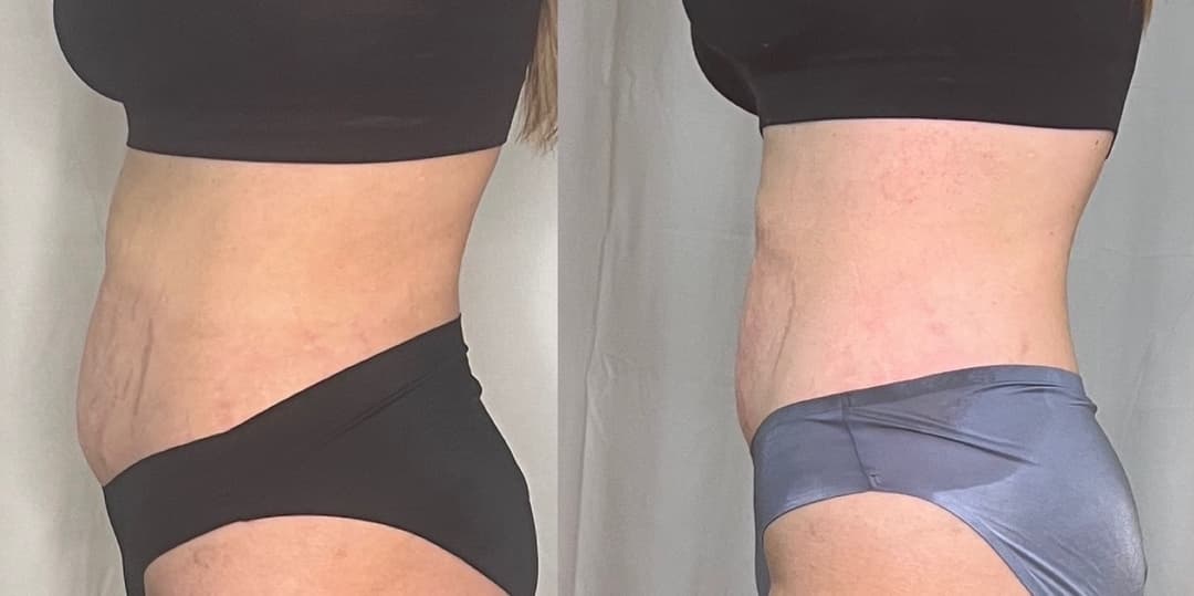client undefined before and after