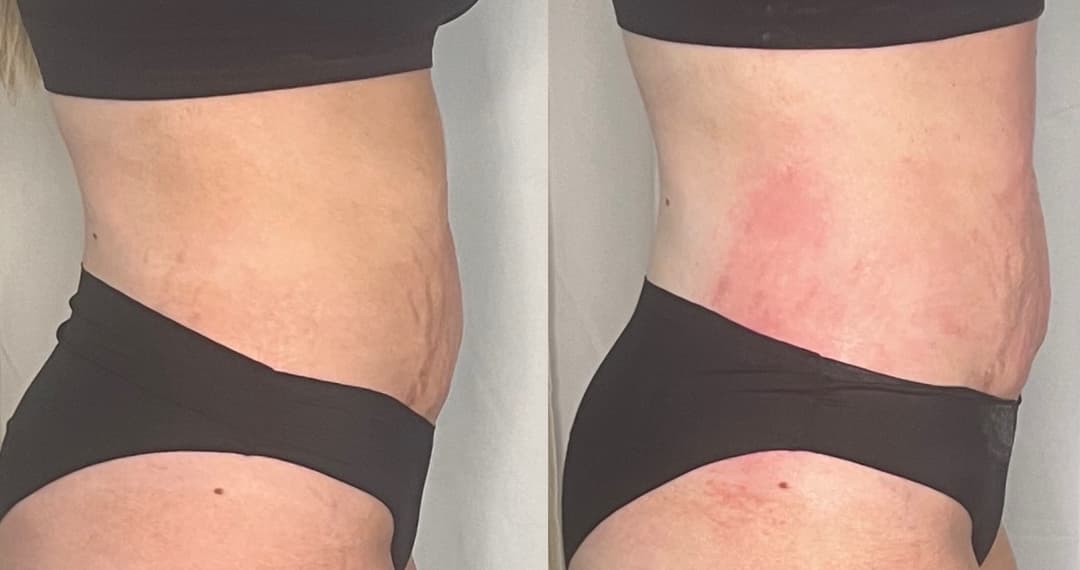 client undefined before and after