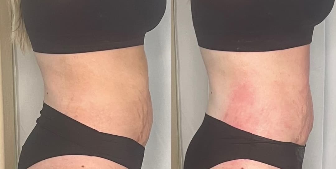 client undefined before and after