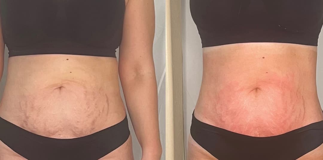 client undefined before and after