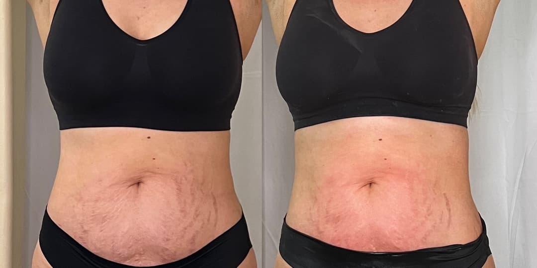 client undefined before and after