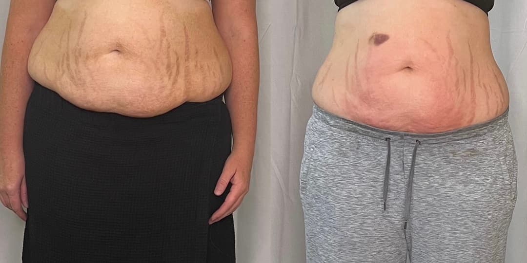 client undefined before and after