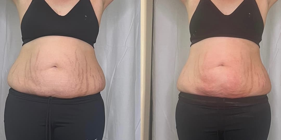 client undefined before and after
