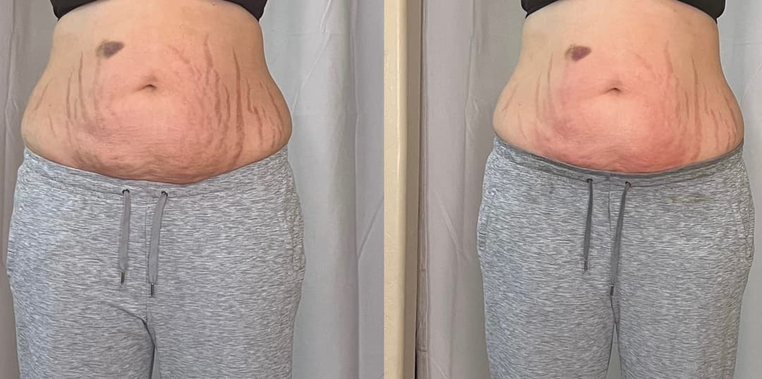client undefined before and after