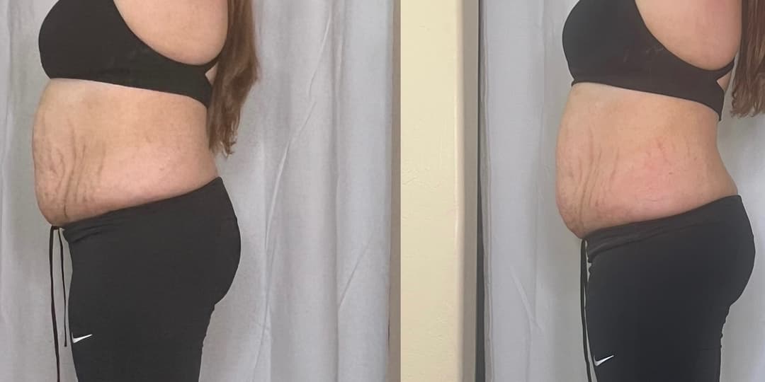 client undefined before and after
