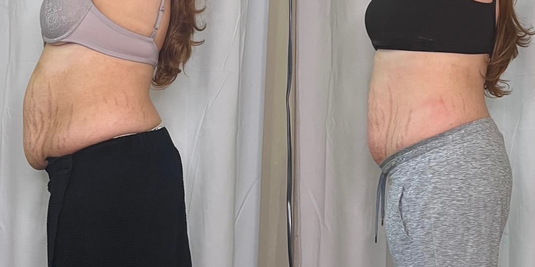 client undefined before and after