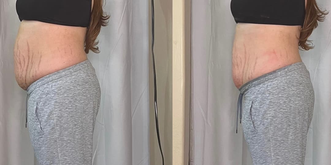 client undefined before and after