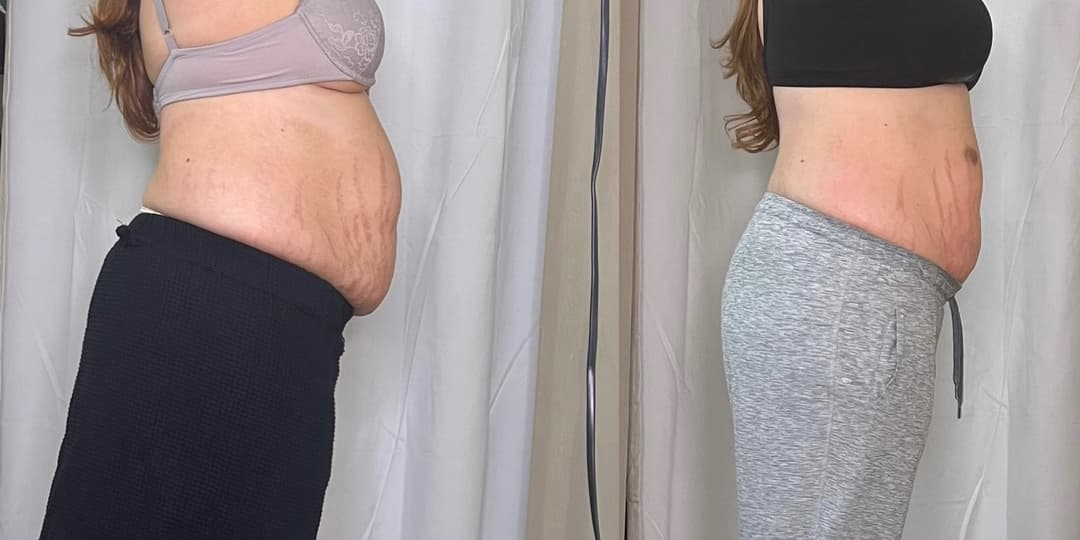 client undefined before and after