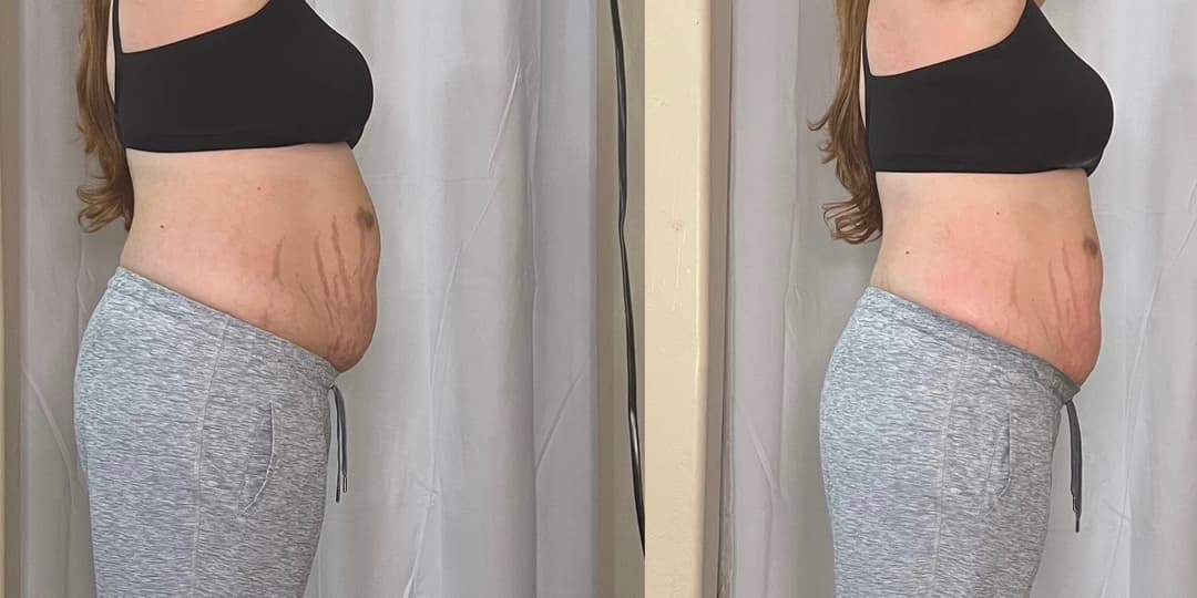 client undefined before and after