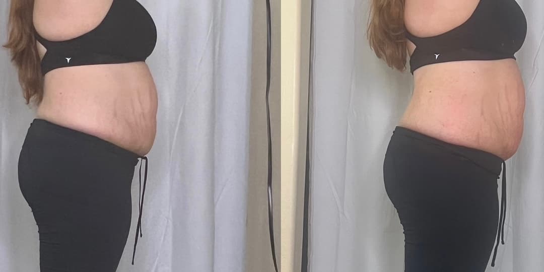 client undefined before and after