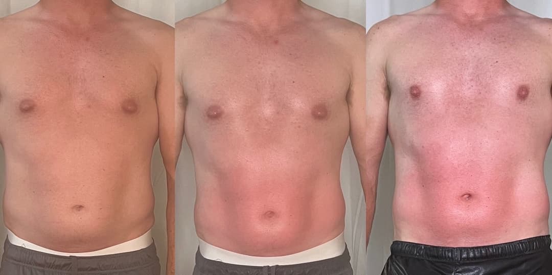 client undefined before and after