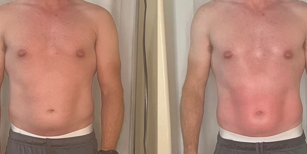 client undefined before and after