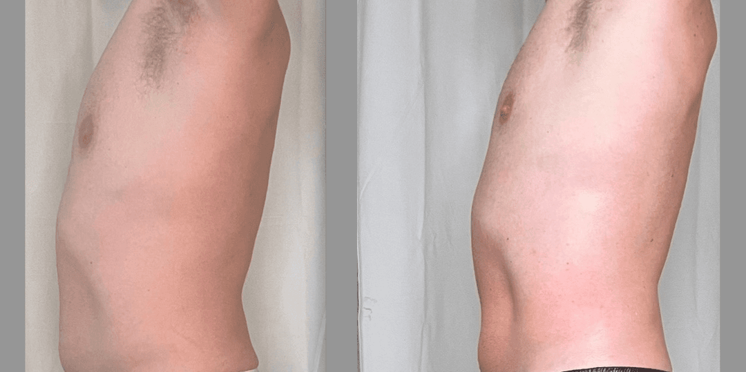 client undefined before and after