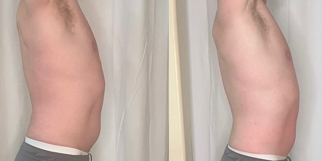 client undefined before and after