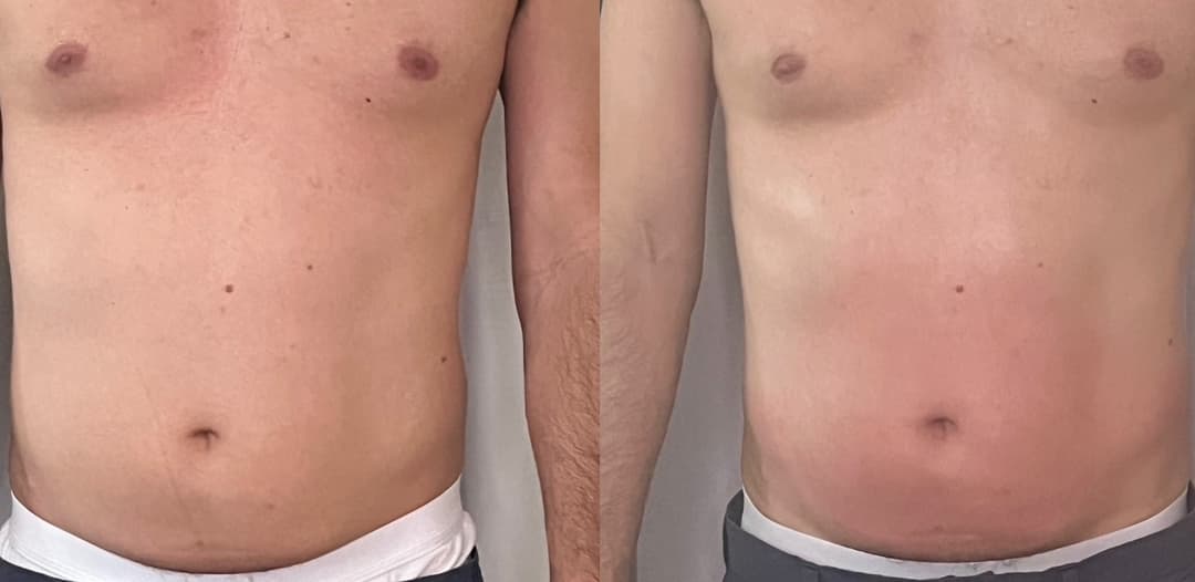 client undefined before and after