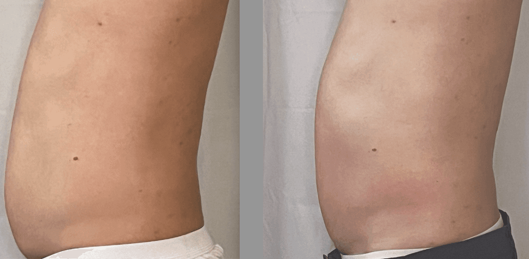 client undefined before and after
