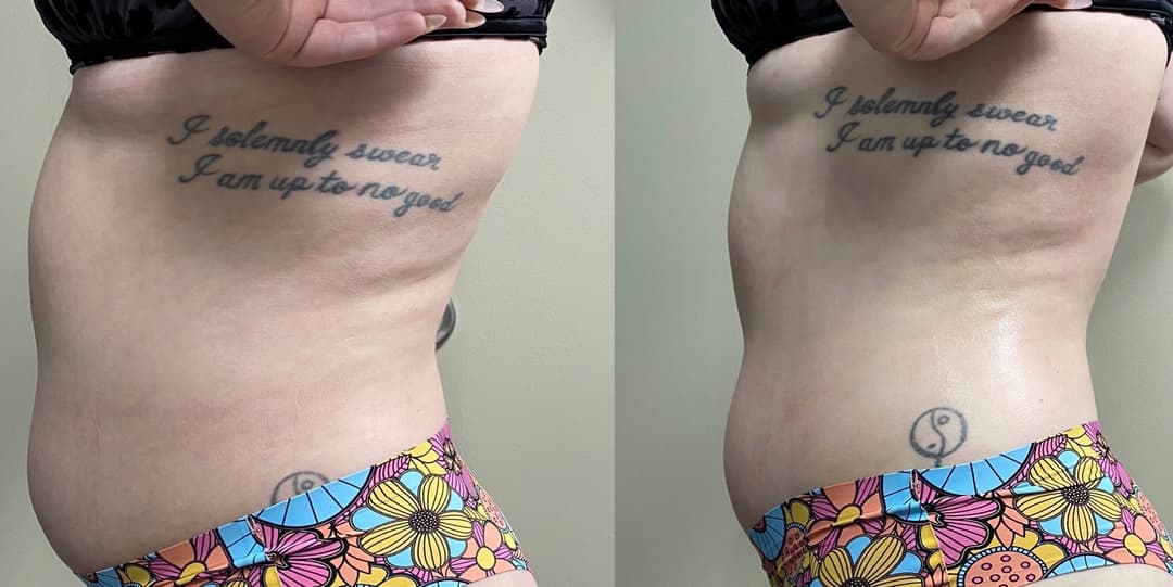 client undefined before and after