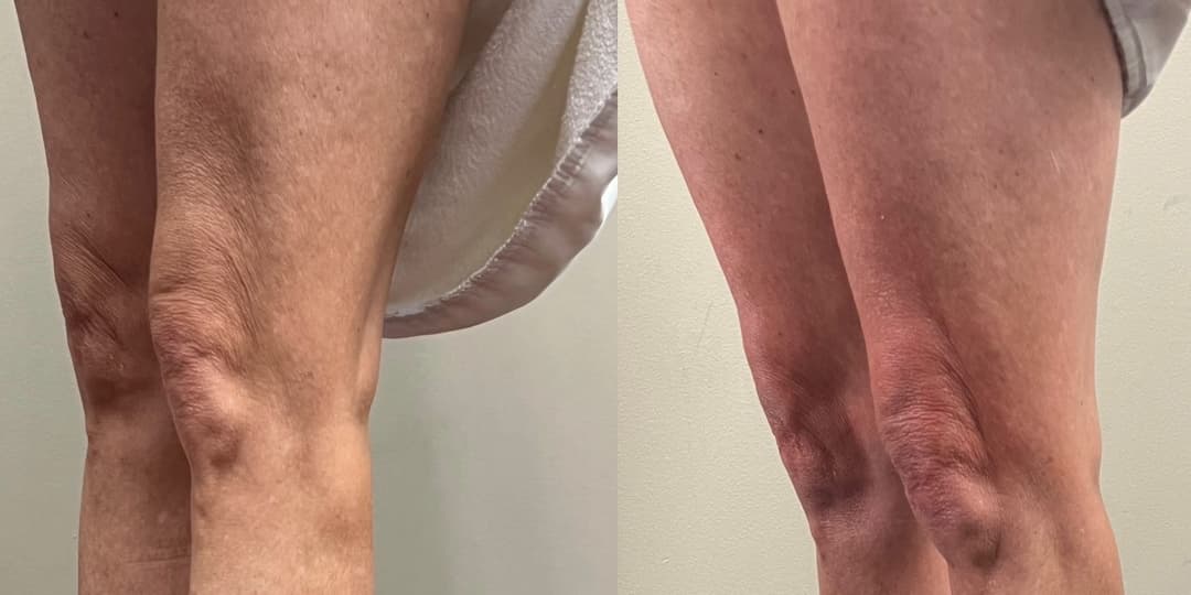 client undefined before and after