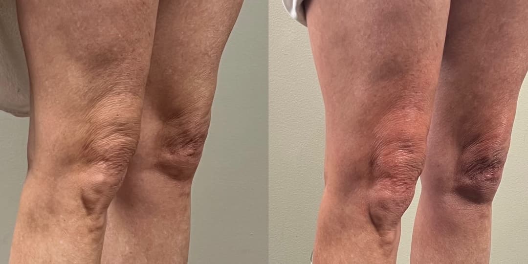 client undefined before and after