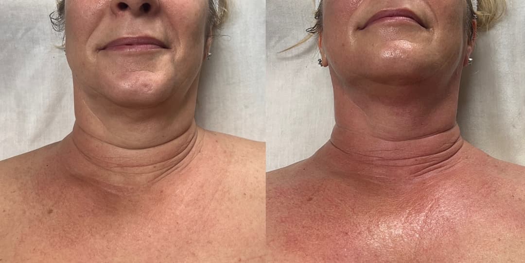 client undefined before and after