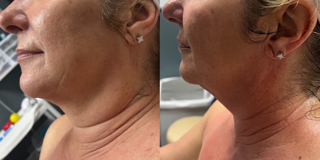 client undefined before and after