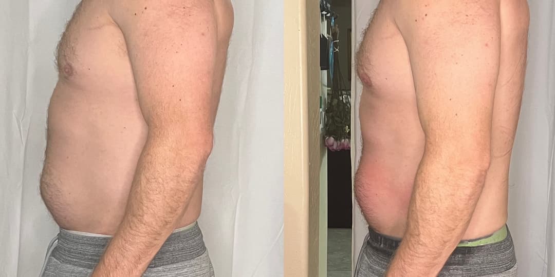 client undefined before and after