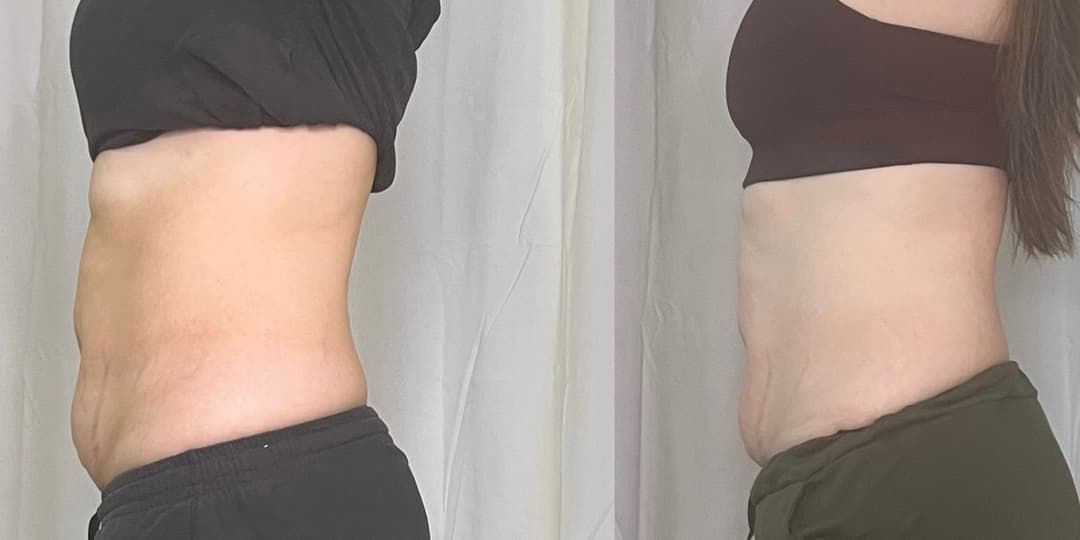 client undefined before and after