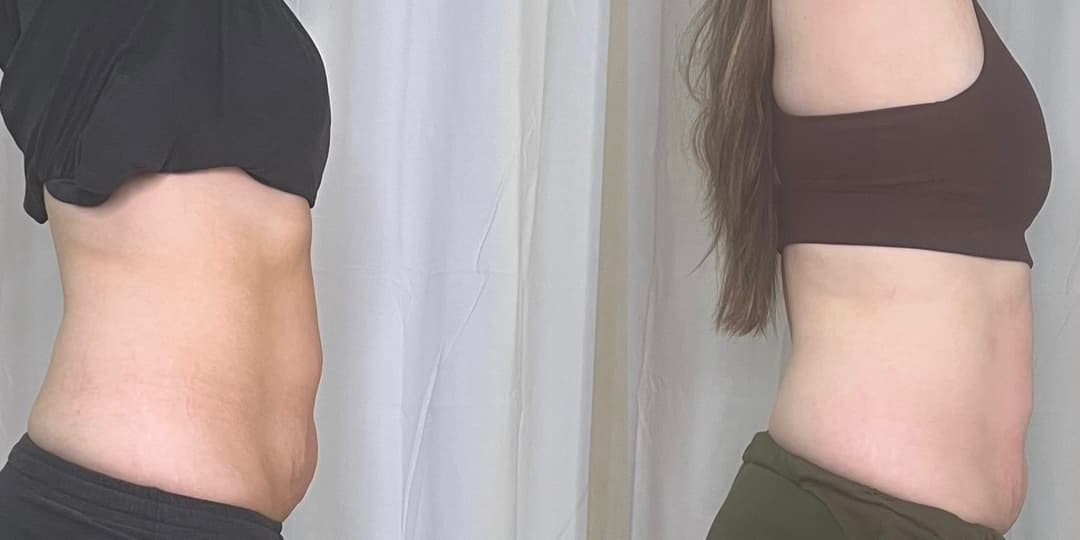 client undefined before and after