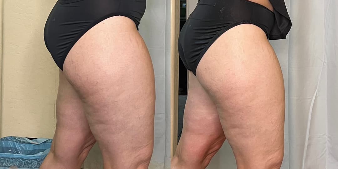 client undefined before and after
