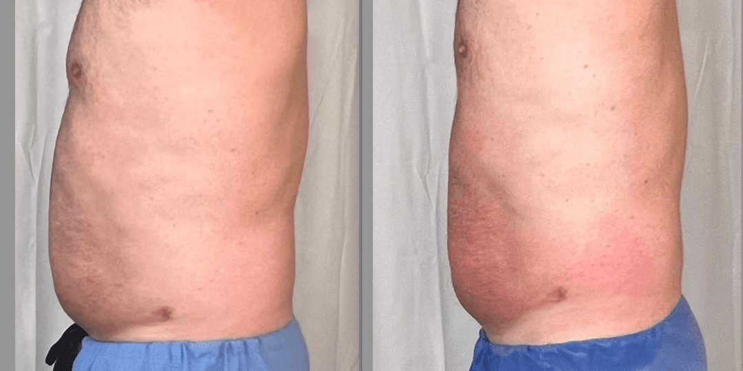 client undefined before and after