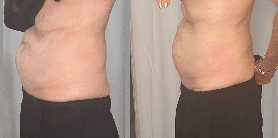 client undefined before and after