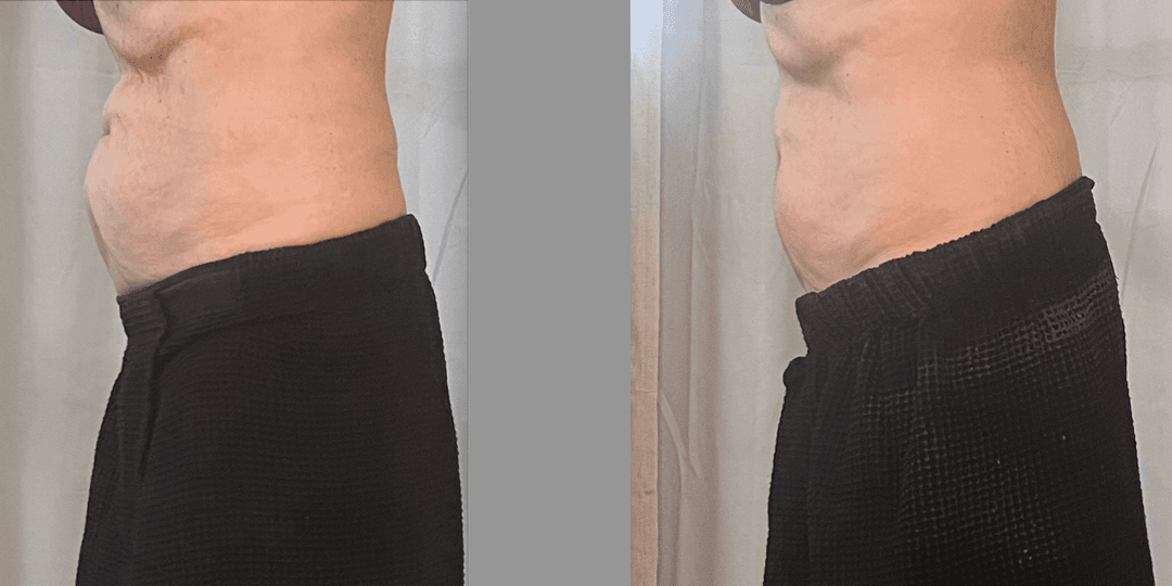 client undefined before and after