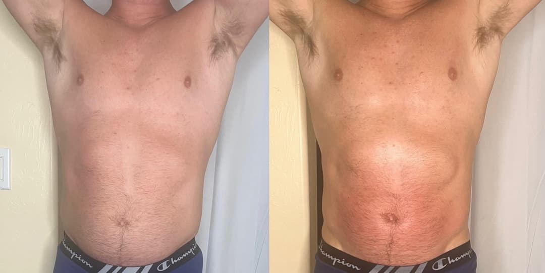 client undefined before and after