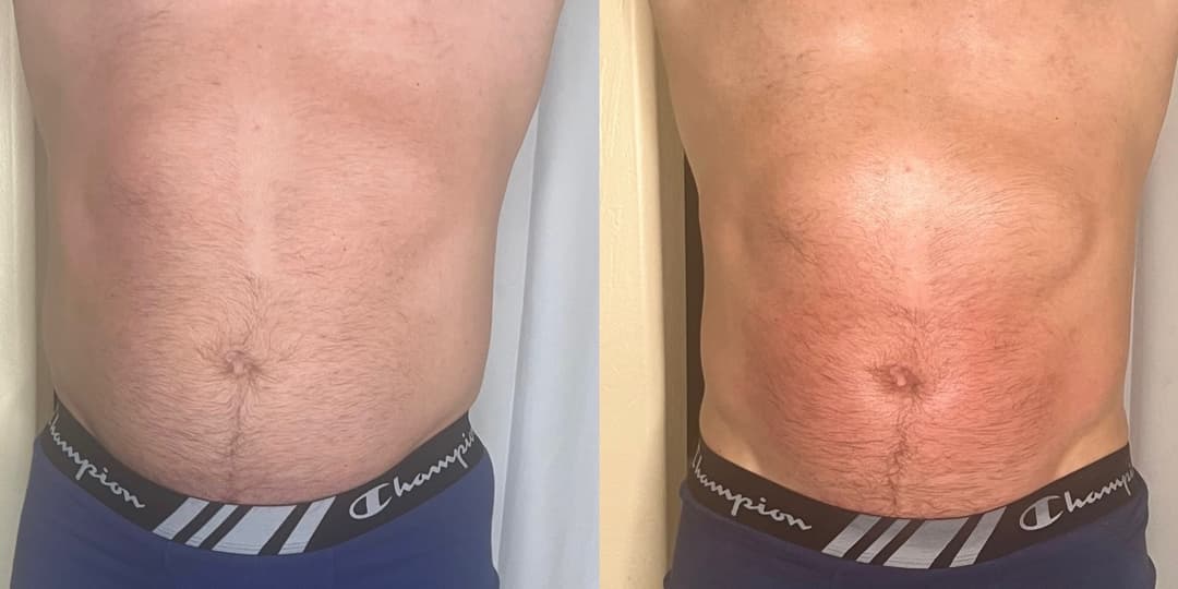 client undefined before and after