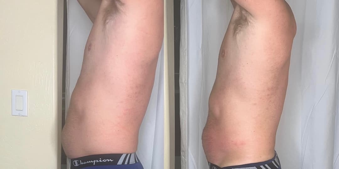client undefined before and after