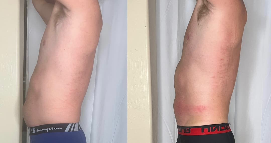 client undefined before and after