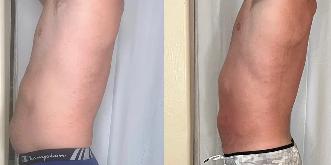 client undefined before and after