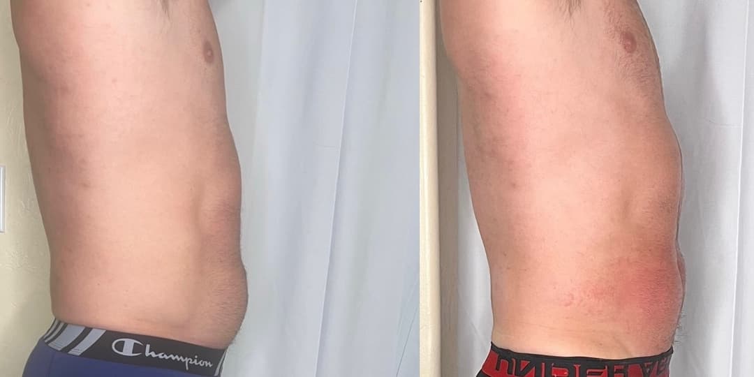 client undefined before and after