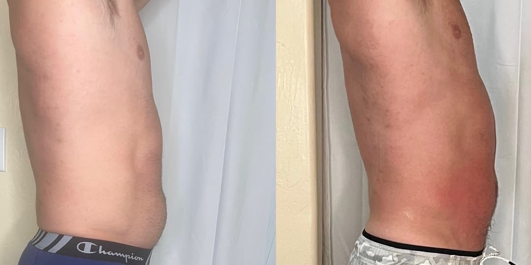 client undefined before and after