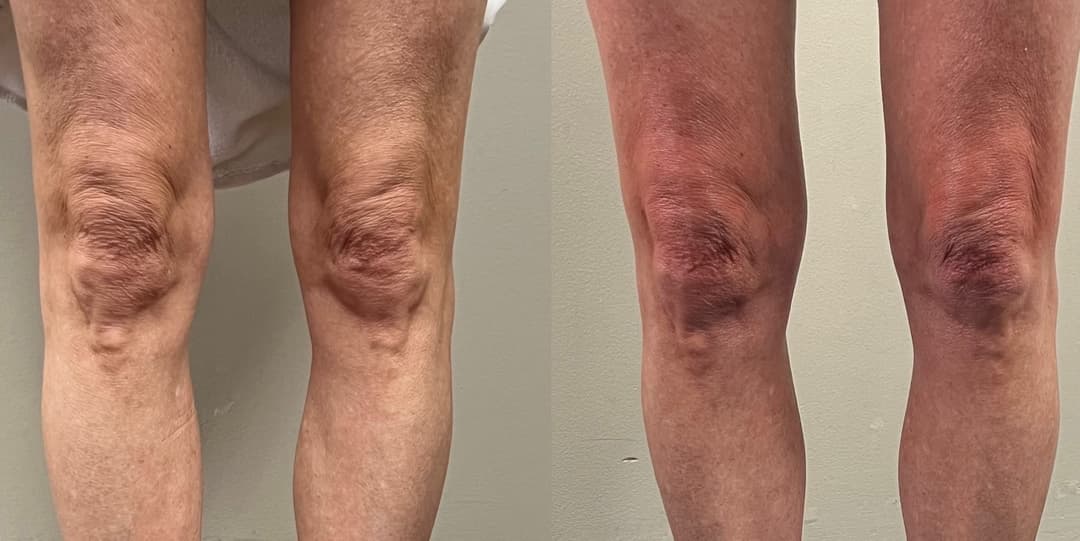client undefined before and after