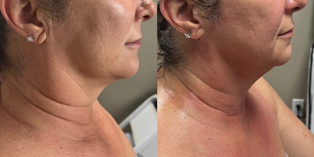 client undefined before and after
