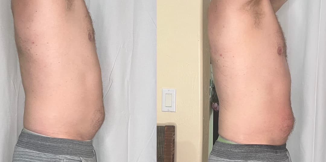 client undefined before and after